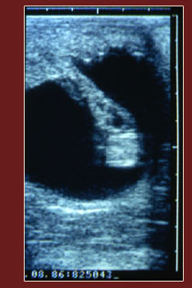 Ultrasonography